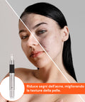 Dr. Fuchs Microneedling Rigenera Pelle Trattamento Rughe