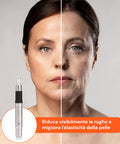 Dr. Fuchs Microneedling Rigenera Pelle Trattamento Rughe