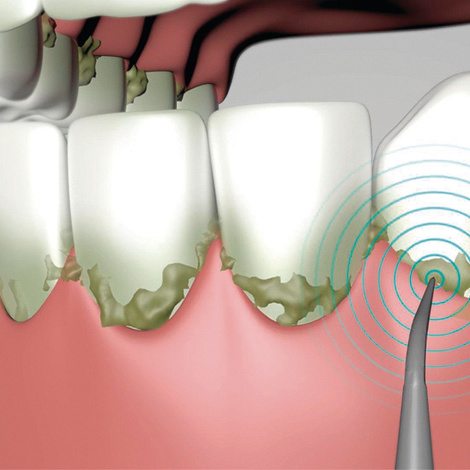 immagine-7-best-direct-spazzolino-da-denti-ad-ultrasuoni-ean-0644812053917